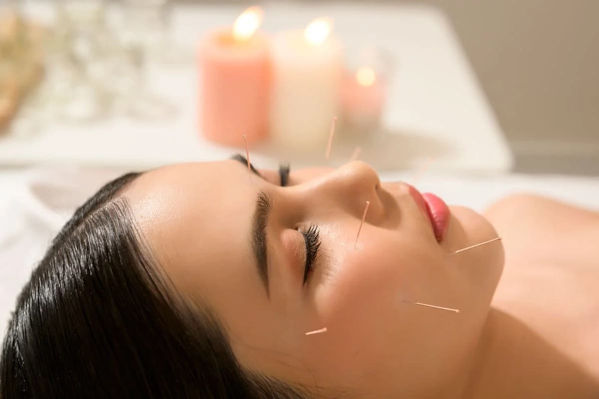 Cosmetic acupuncture