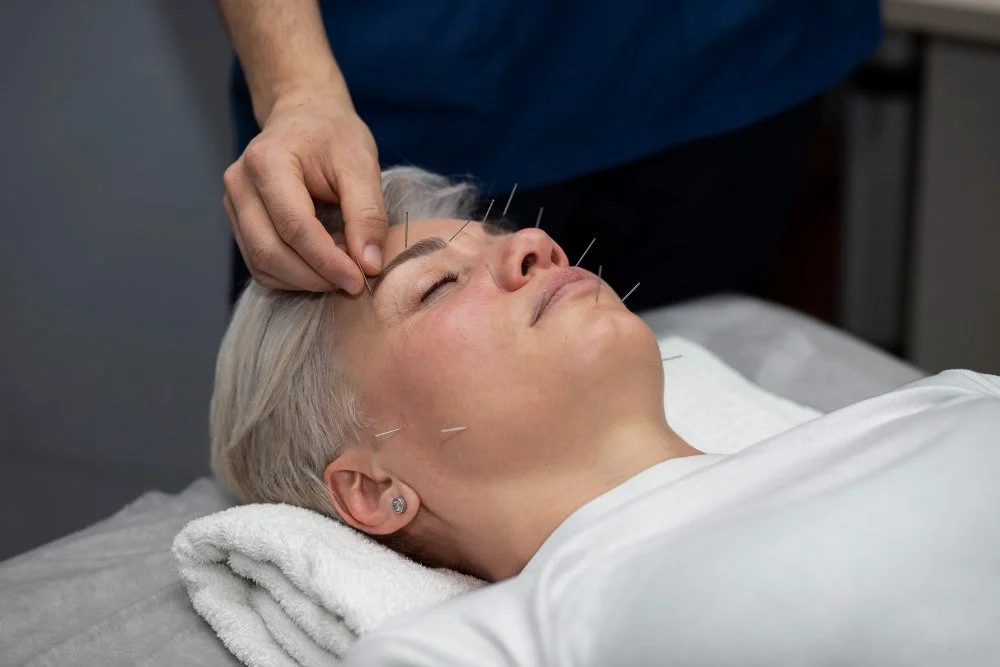 Cosmetic Acupuncture
